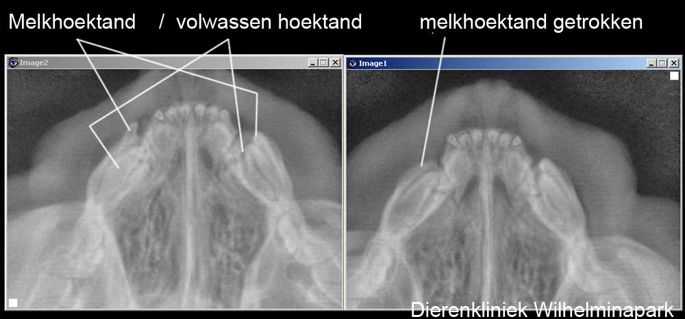 De linker boven melkhoektand is getrokken